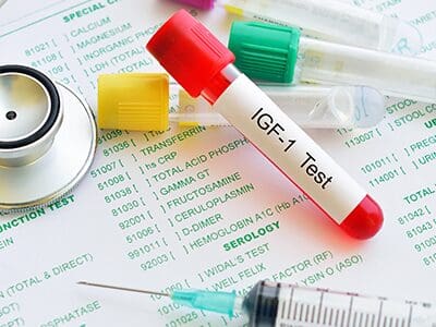 A blood sample tube labeled IGF 1 Test