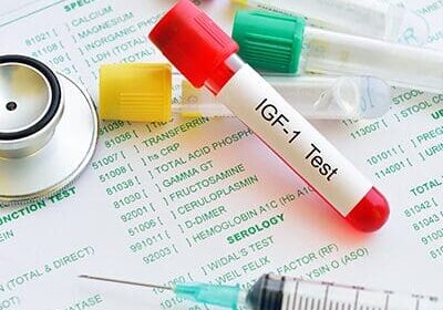 A blood sample tube labeled IGF 1 Test